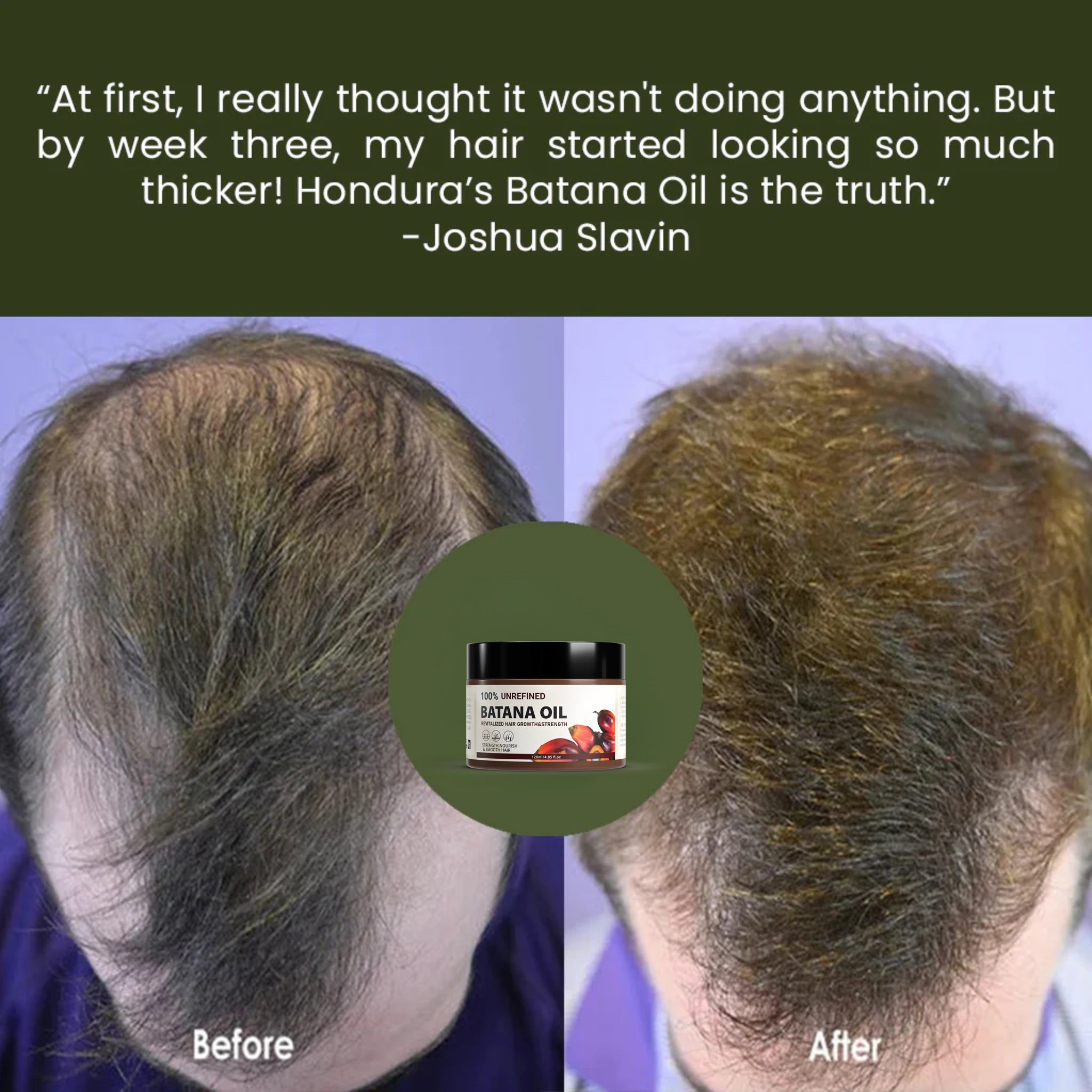 VIRAL Batana Oil Hair Repair Treatment