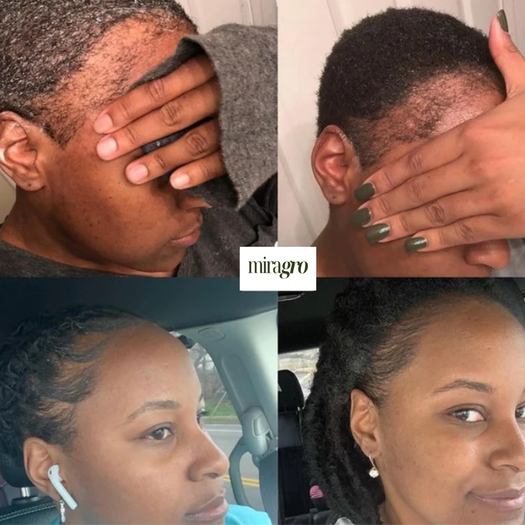 Edges Growth Cream - Buy One Get One FREE